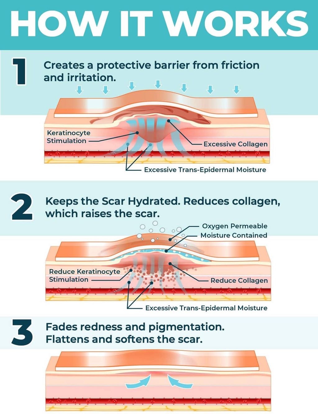 Medical-grade silicone scar sheet cross-section diagram showing protective barrier