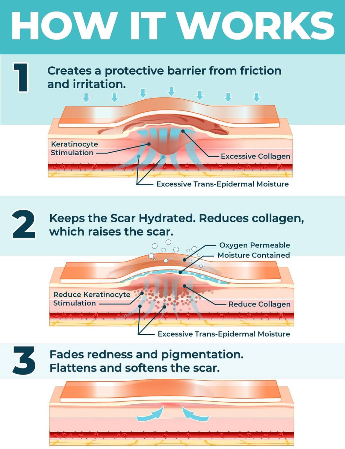 Medical-grade silicone scar sheet cross-section diagram showing protective barrier