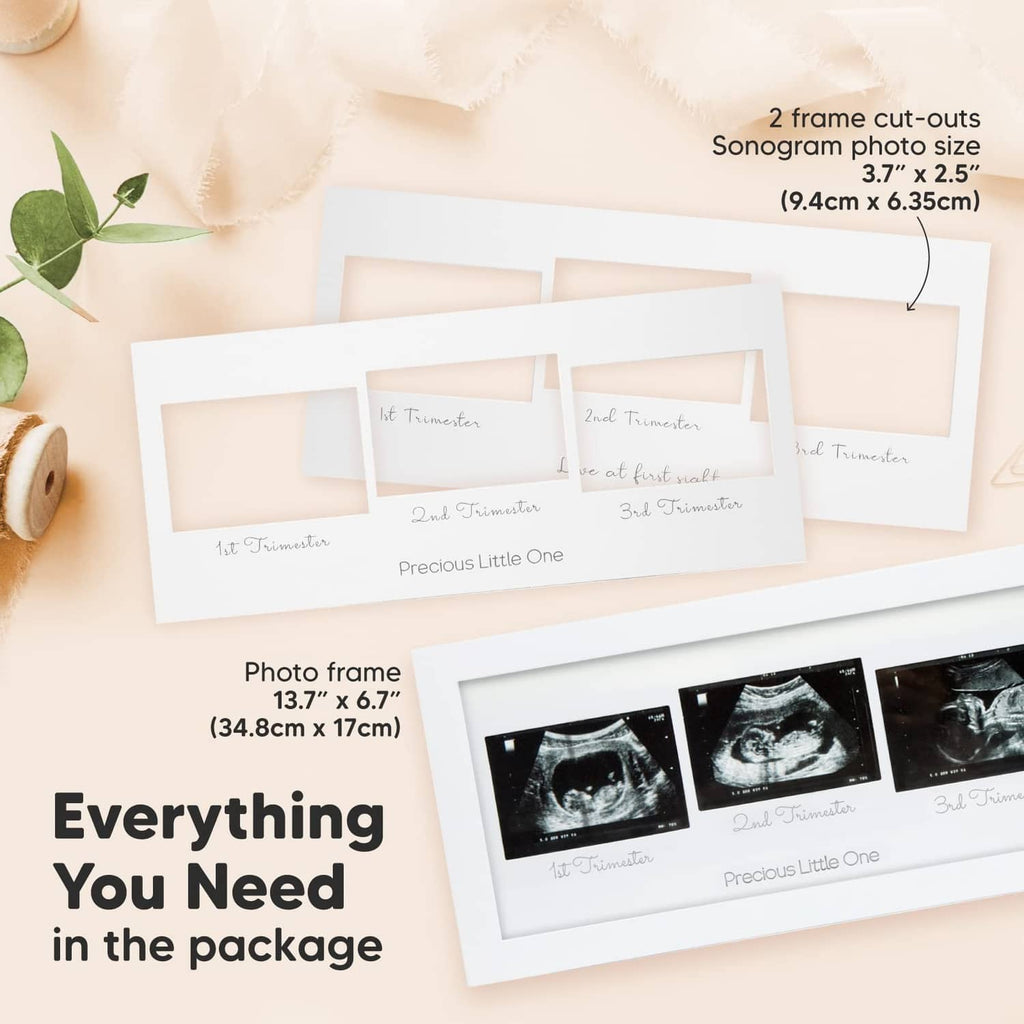 Ultrasound photo frame set with three sonogram photos on white inserts
