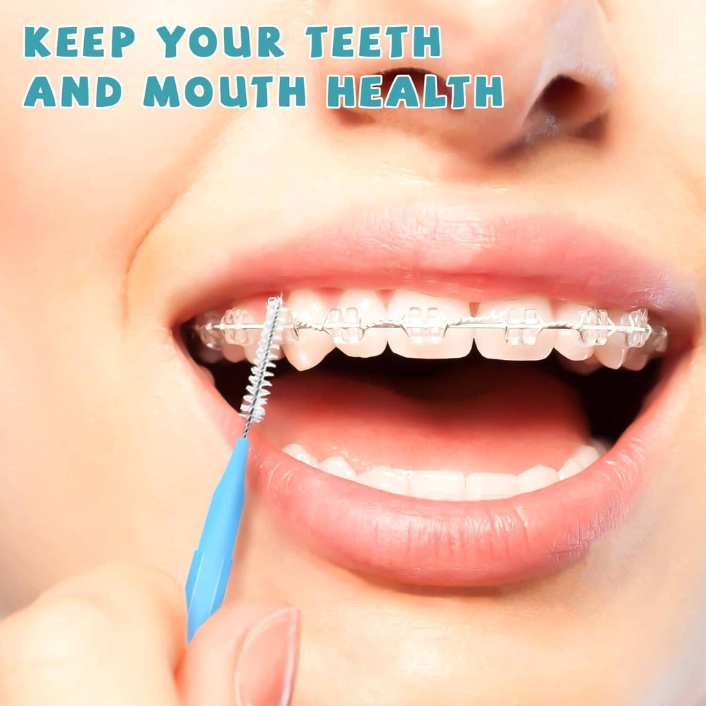 Interdental brush cleaning between teeth with braces