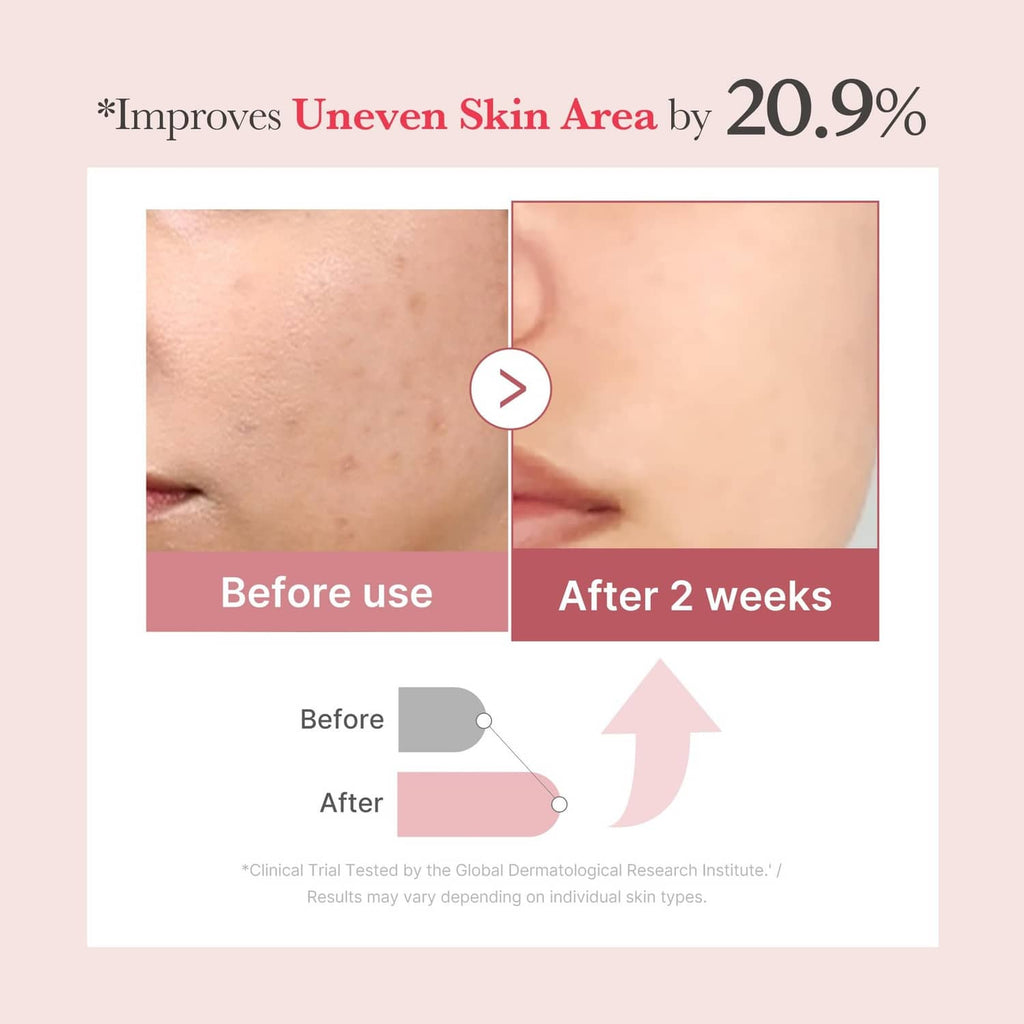 Before-and-after skincare results graphic showing 20.9% uneven skin area improvement