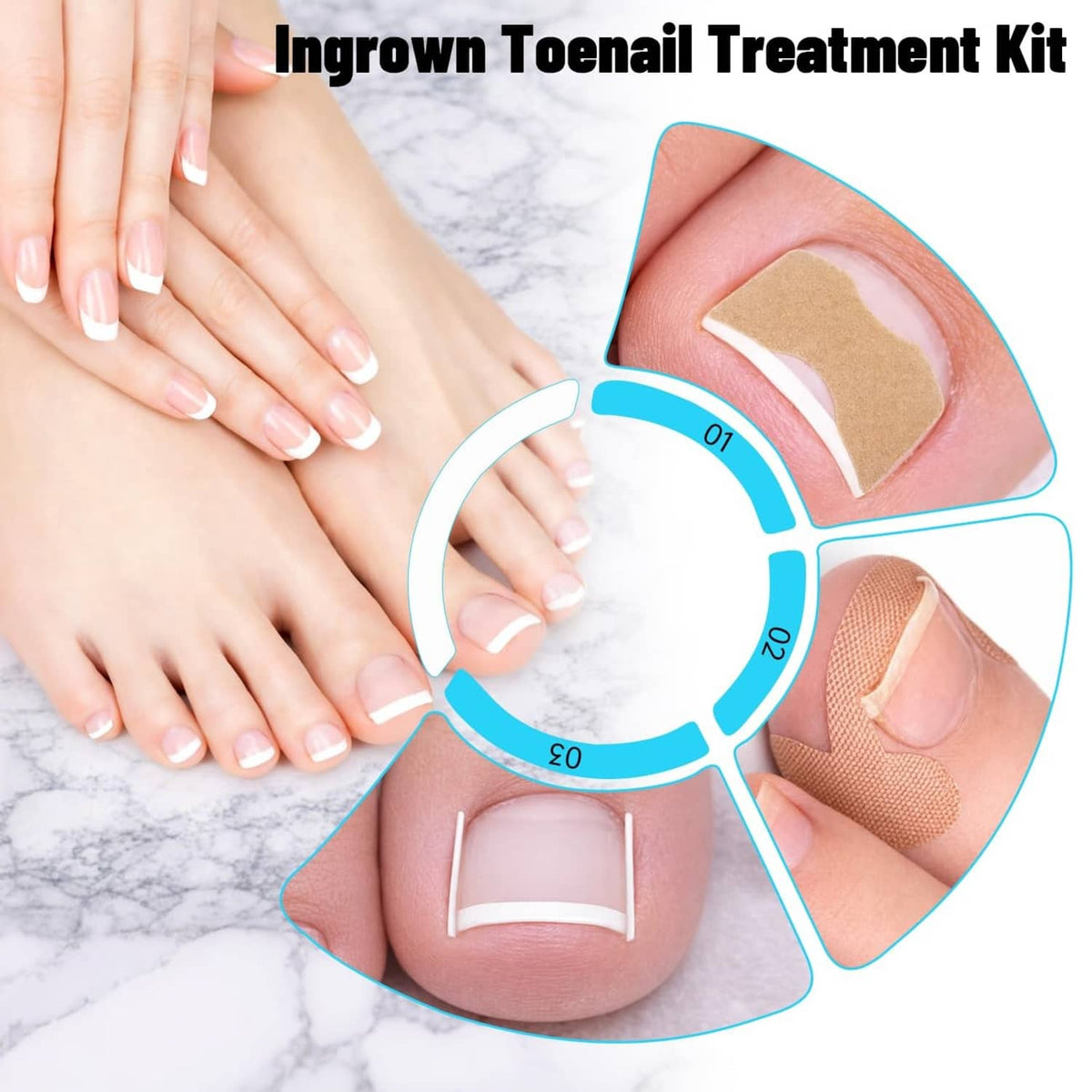 Ingrown toenail treatment kit with adhesive pad and silver tool for toe care