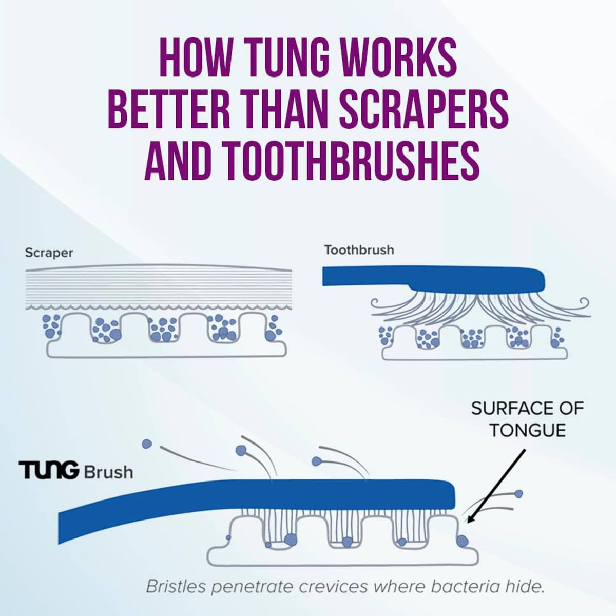 Tongue brush bristle head shown over tongue surface for effective cleaning