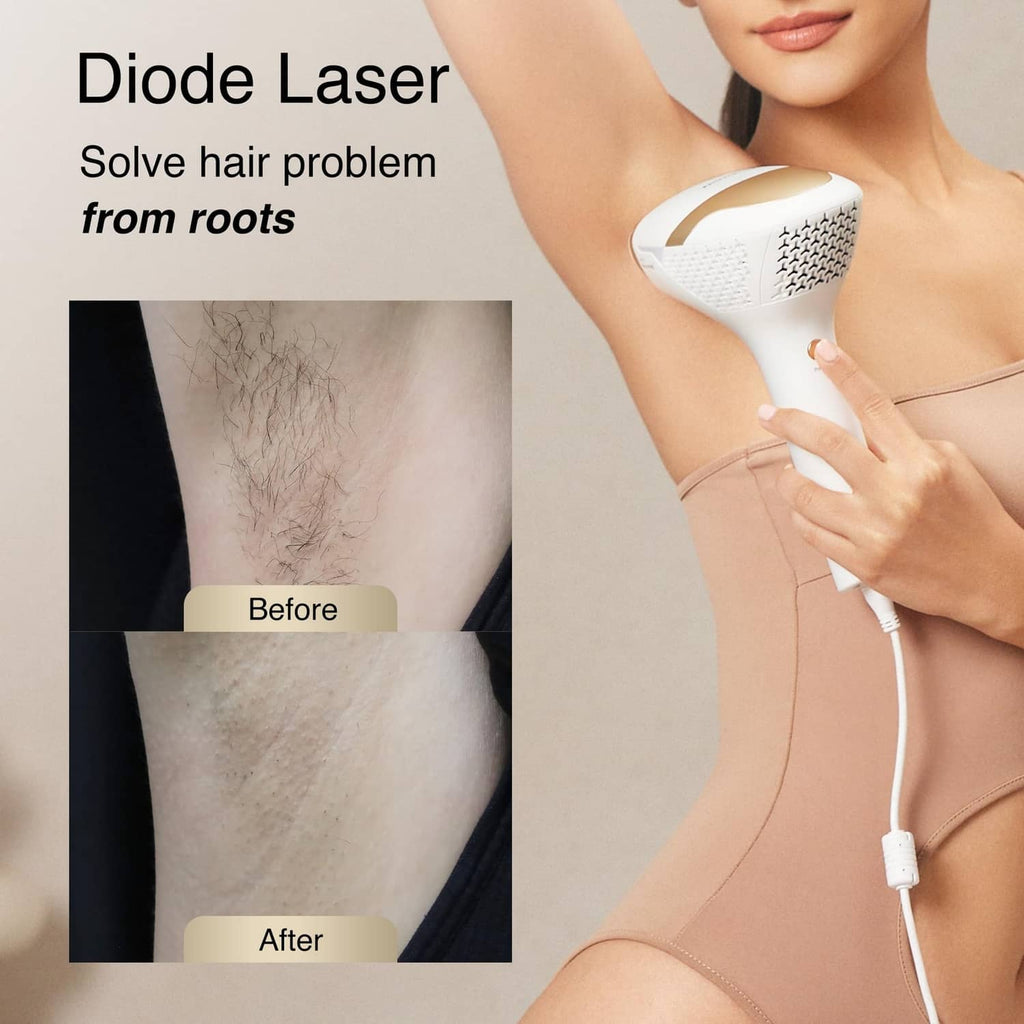 Laser hair removal device over skin with before-and-after hair reduction panel