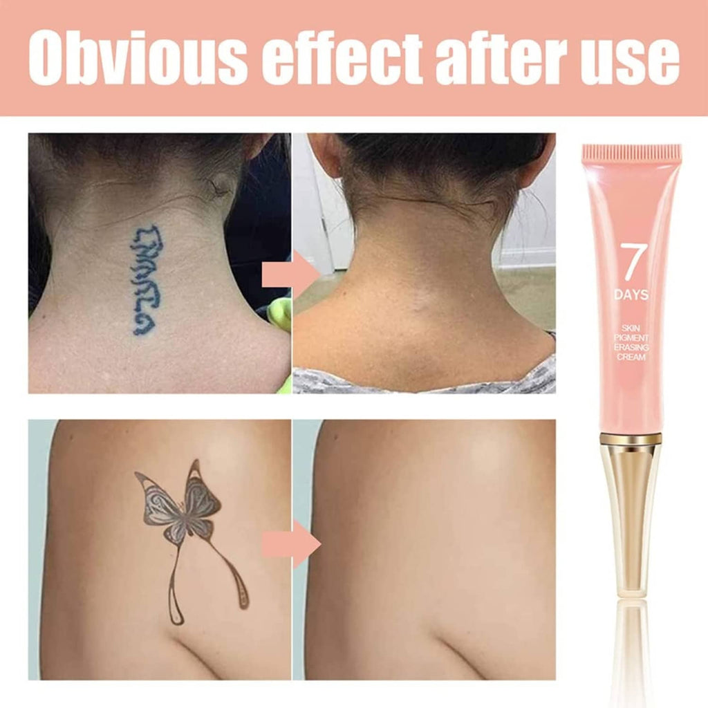 Tattoo erasing cream with visible tattoo fading on skin areas; tube included
