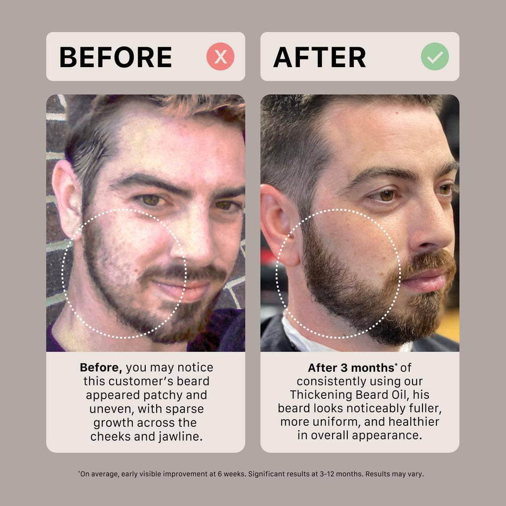 Beard growth before-and-after infographic showing fuller-looking beard after treatment