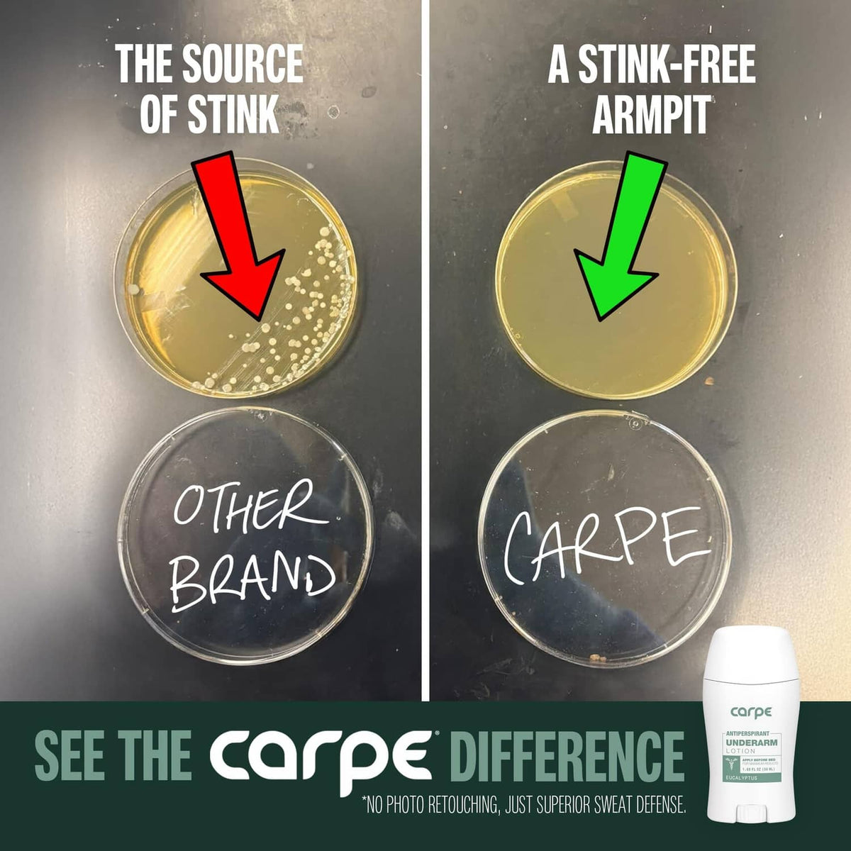 Carpe underarm antiperspirant lotion bottle shown beside stain-comparison graphic