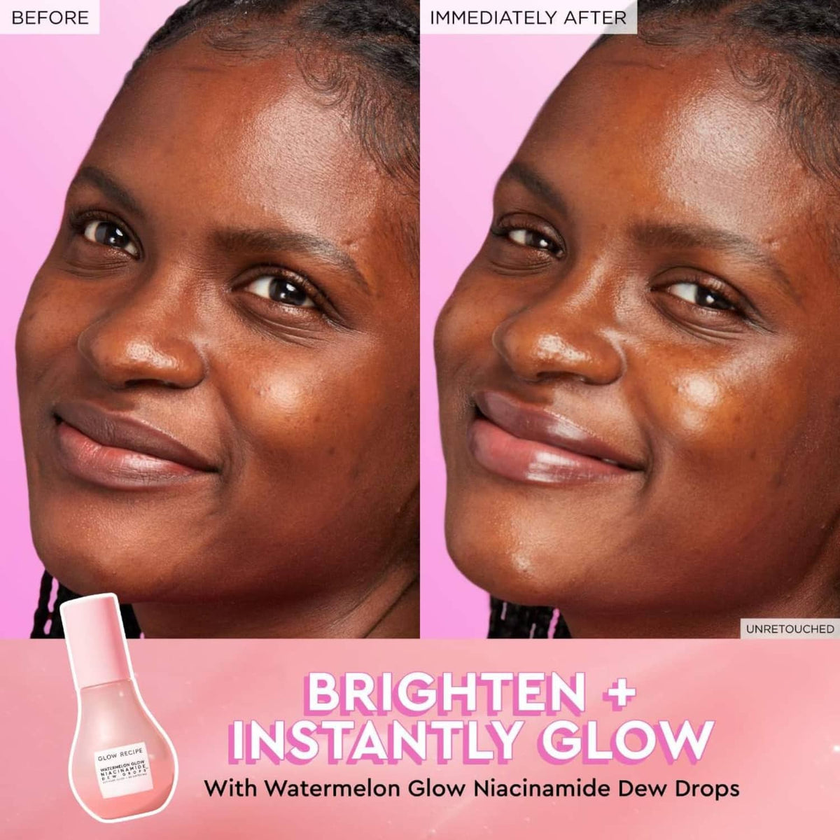 Glow Recipe watermelon glow niacinamide dew drops bottle beside before-and-after faces