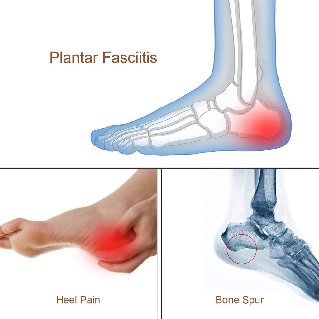 Foot heel pain diagram with red sore spot for plantar fasciitis and bone spur