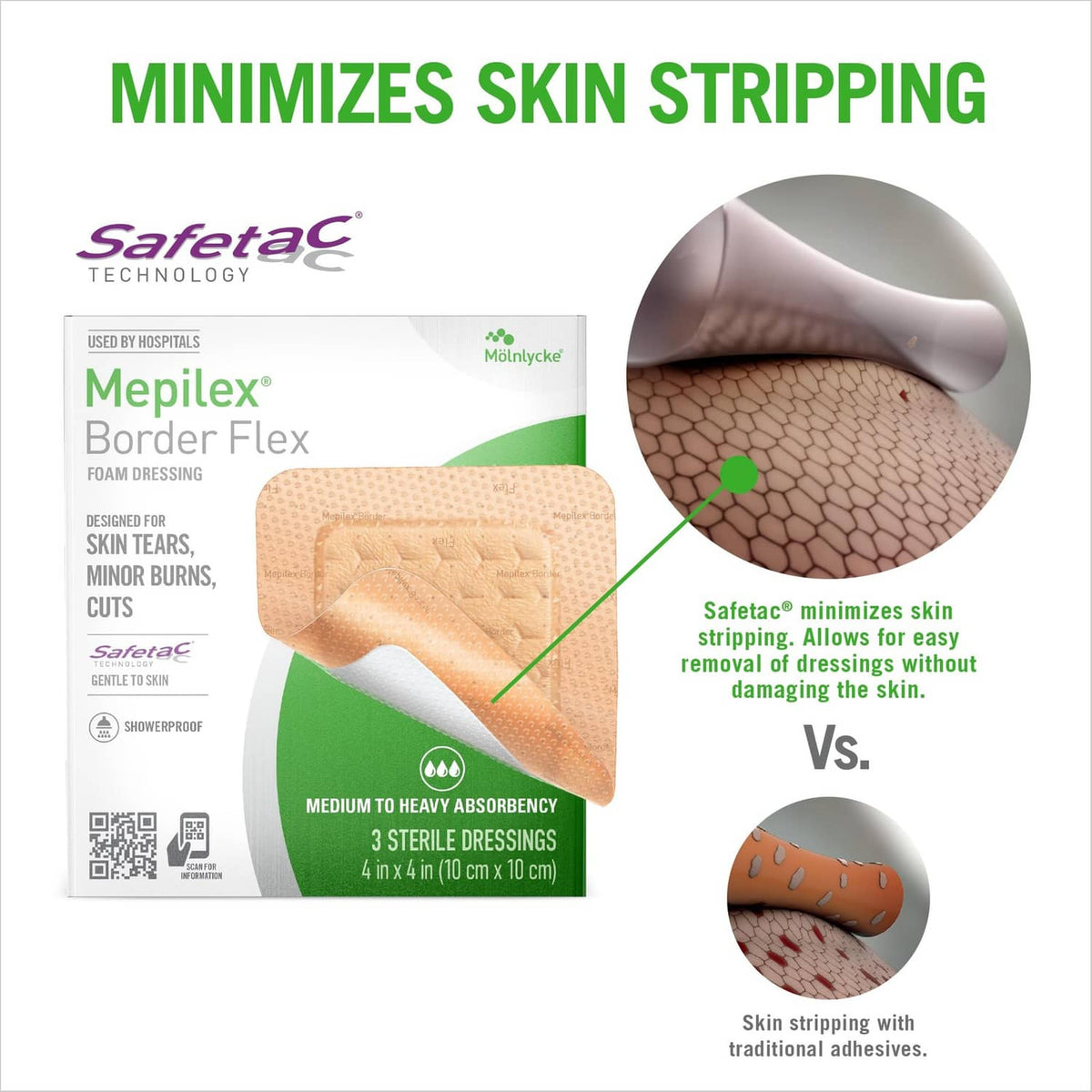 Beige Mepilex Border Flex foam dressing with skin-stripping safety graphic