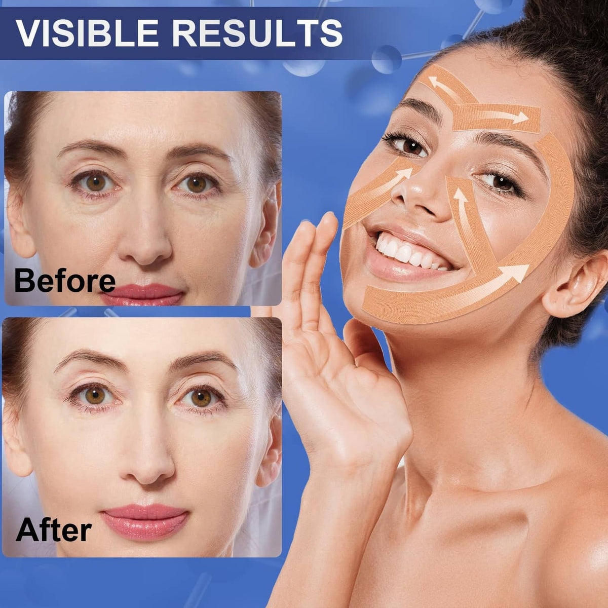 Beige tape strips placed across face for wrinkle support, shown on a person