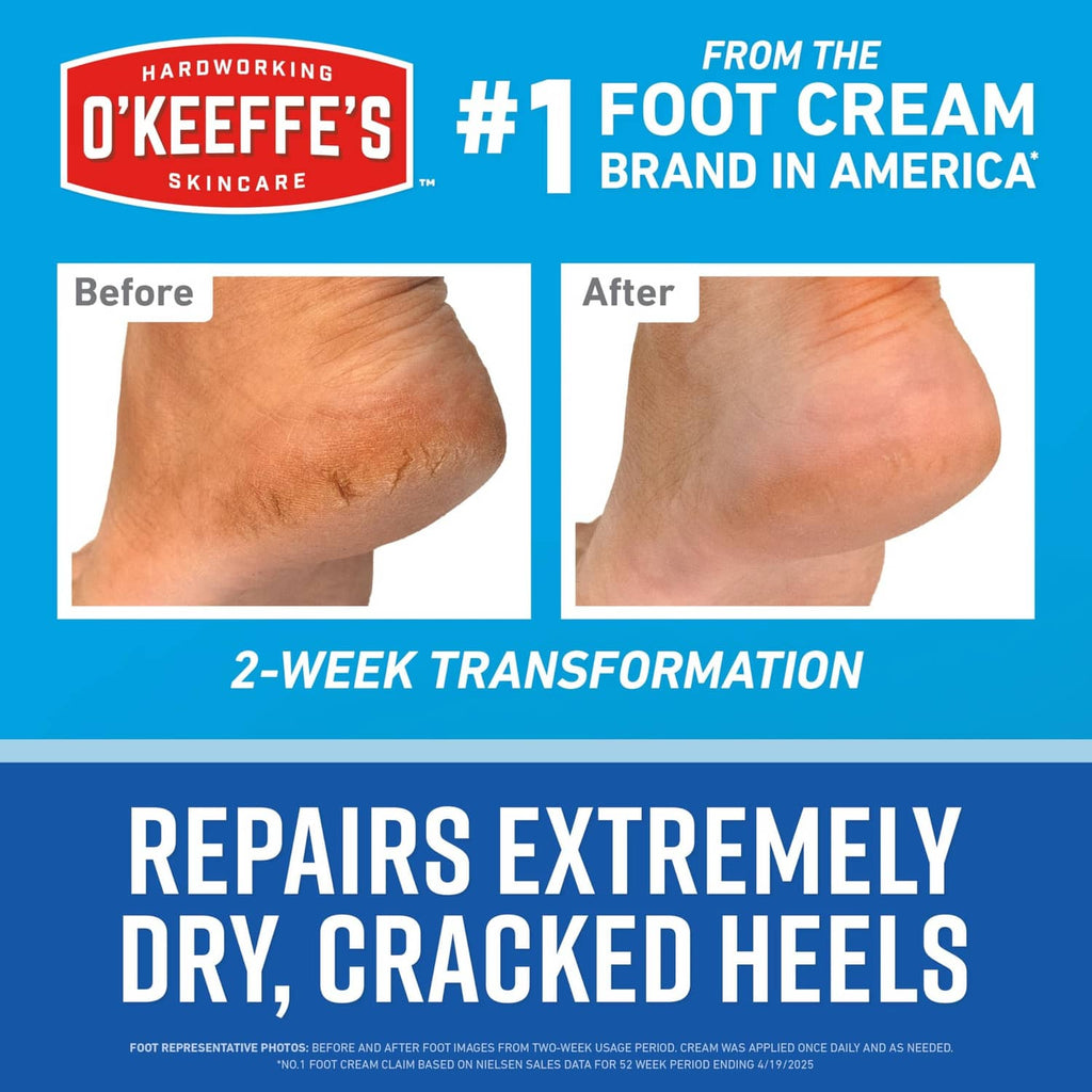 Healthy Feet heel repair kit before-and-after: repairs extremely dry, cracked heels