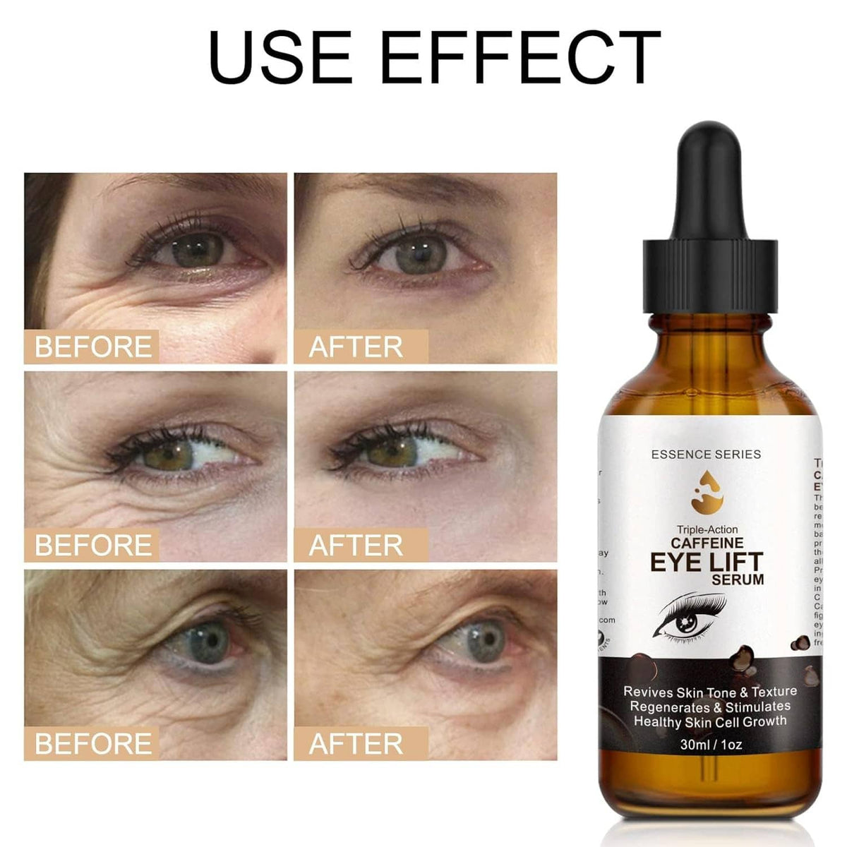 Caffeine eye serum bottle with black dropper next to before-and-after eye close-ups