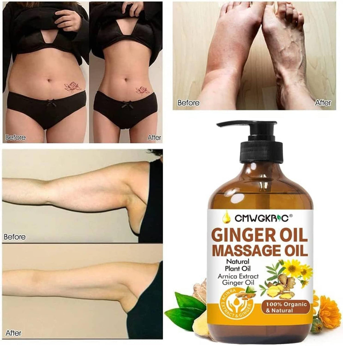 Ginger oil massage oil bottle with black pump beside before-and-after body photos.