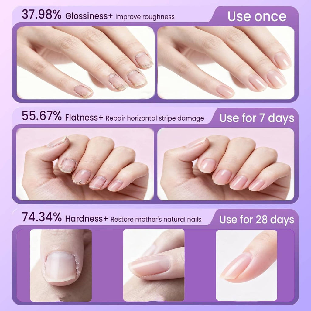 Cuticle oil pen shown with hands during nail care before-and-after