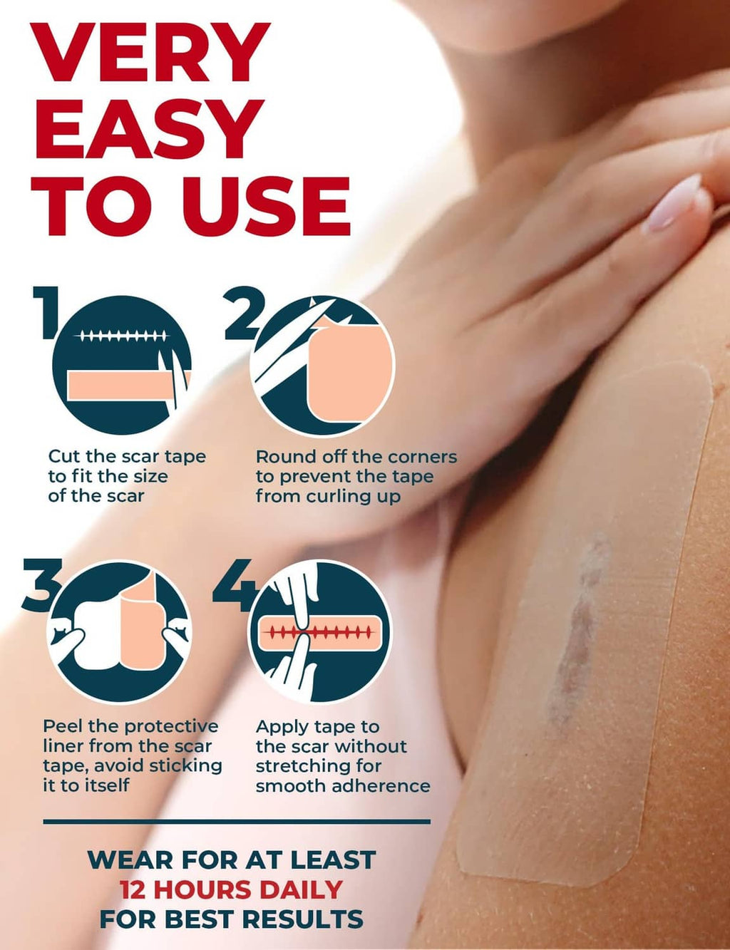 Transparent silicone scar sheet smoothed on skin with clear edges visible