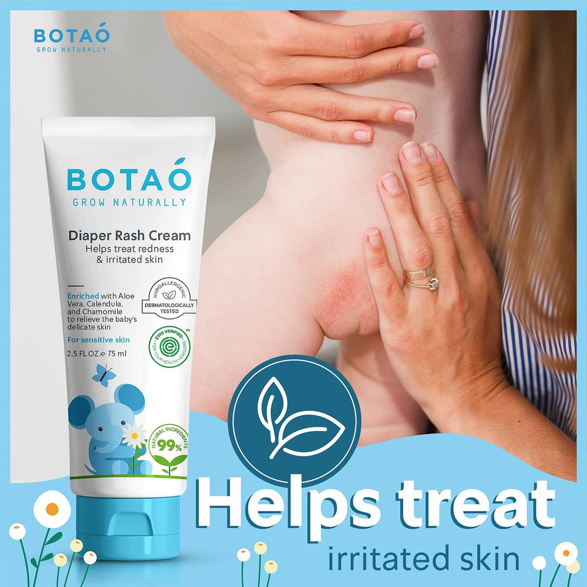 Diaper rash cream tube next to hands applying soothing cream to irritated skin.