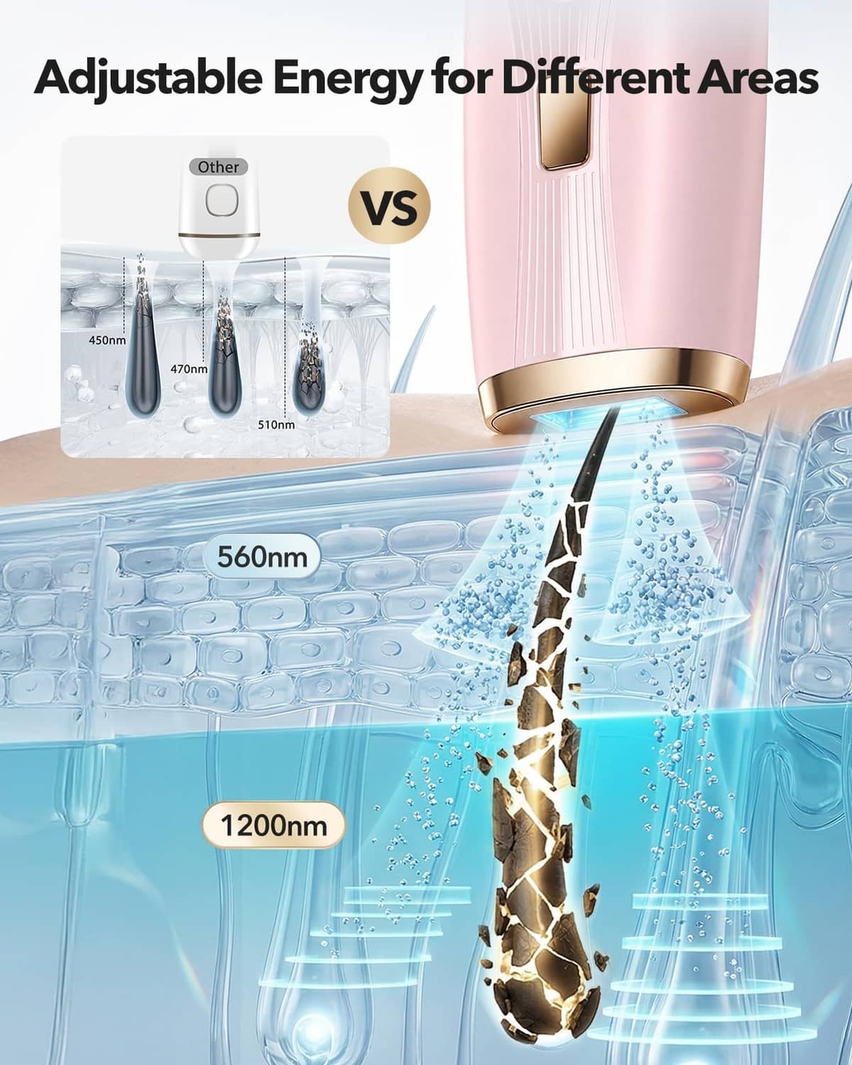 Pink IPL device with windowed treatment head emitting blue cooling light.