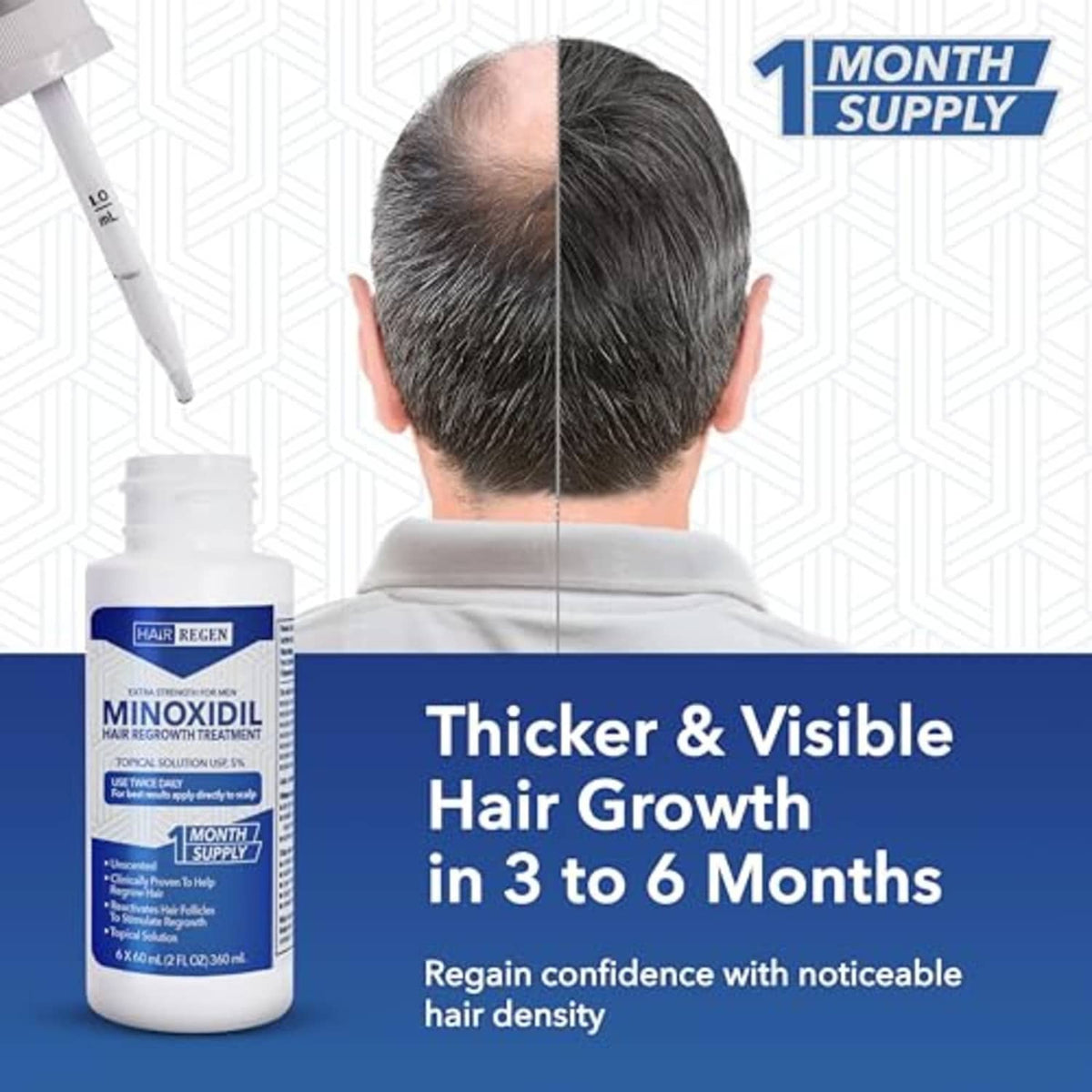 Minoxidil 5% topical solution bottle and dropper applicator for thicker hair growth