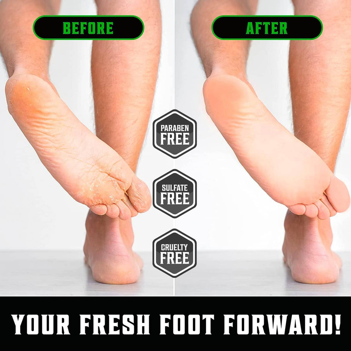 Before-and-after feet care with dry heels; tea tree foot cream benefits icons