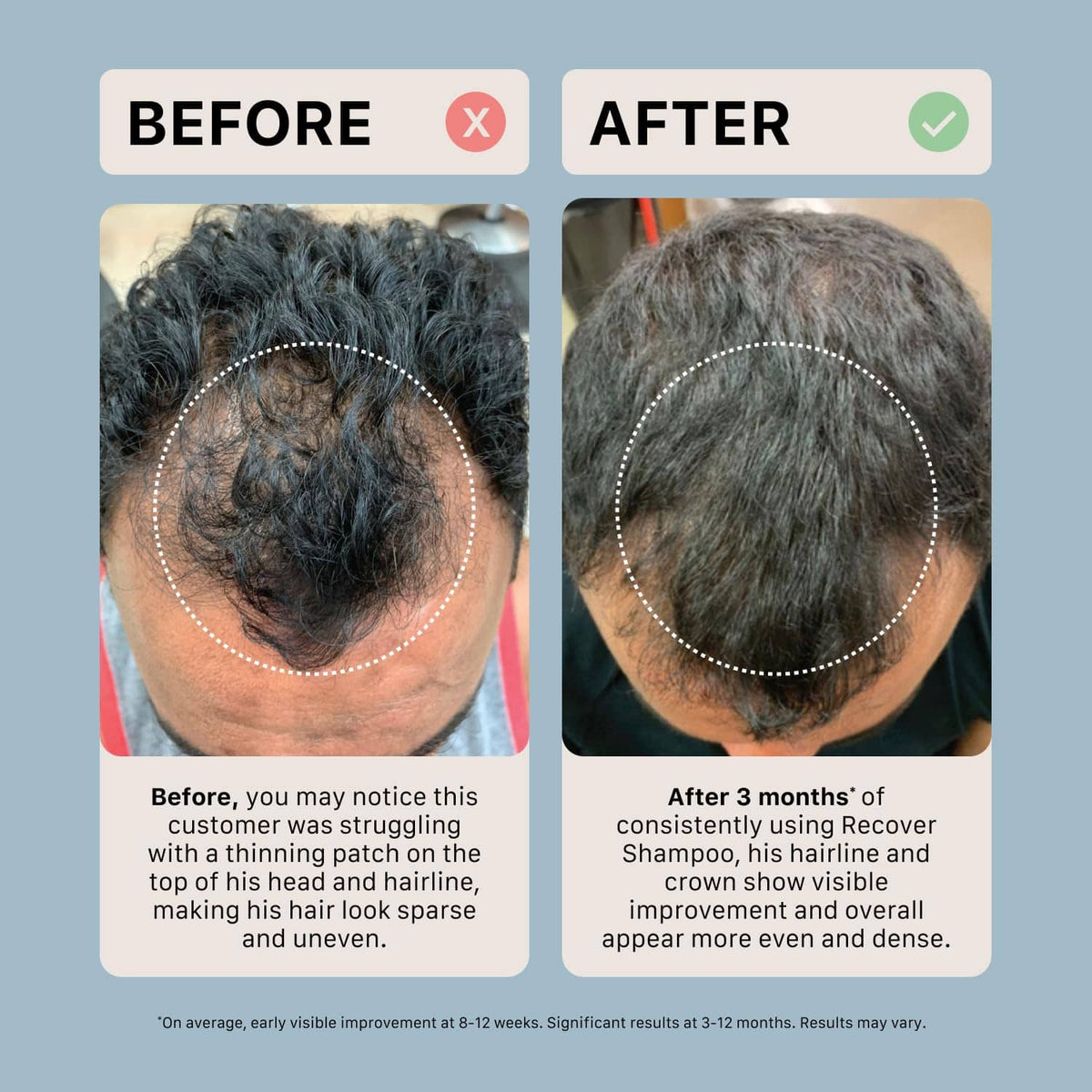 Hair growth before-and-after infographic showing thicker-looking scalp after treatment