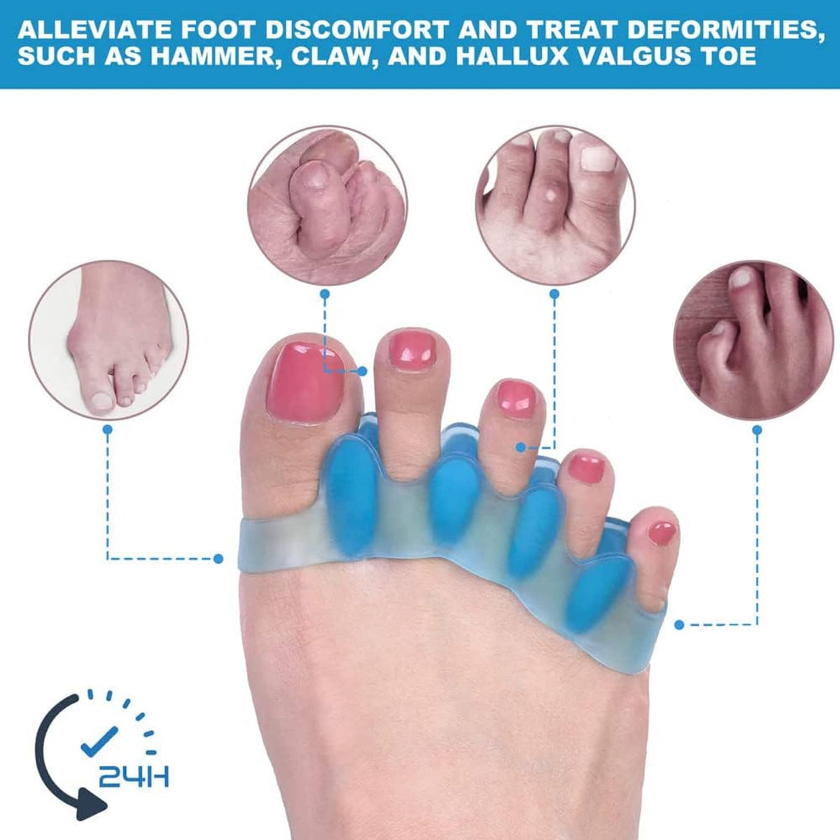 Blue gel toe separator pads for bunion correction, with adjustable toe spacing