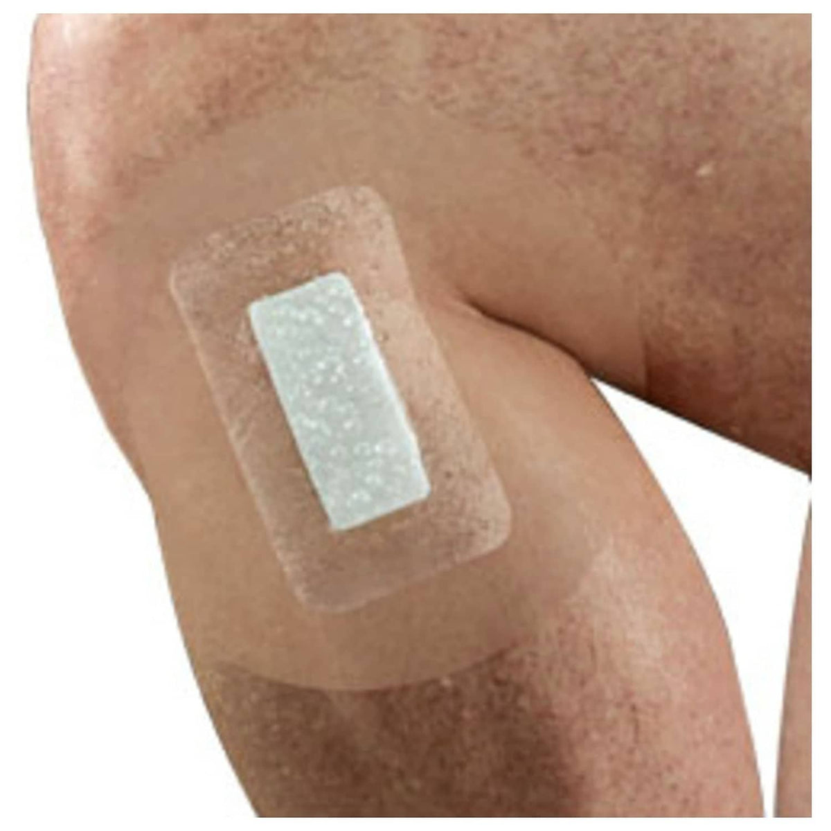 Transparent square dressing pad adhered to skin over a wound