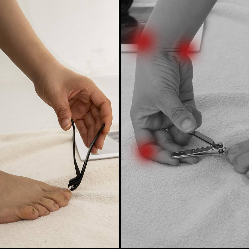 Long-handled toenail clippers being used to cut a toenail on an open foot.