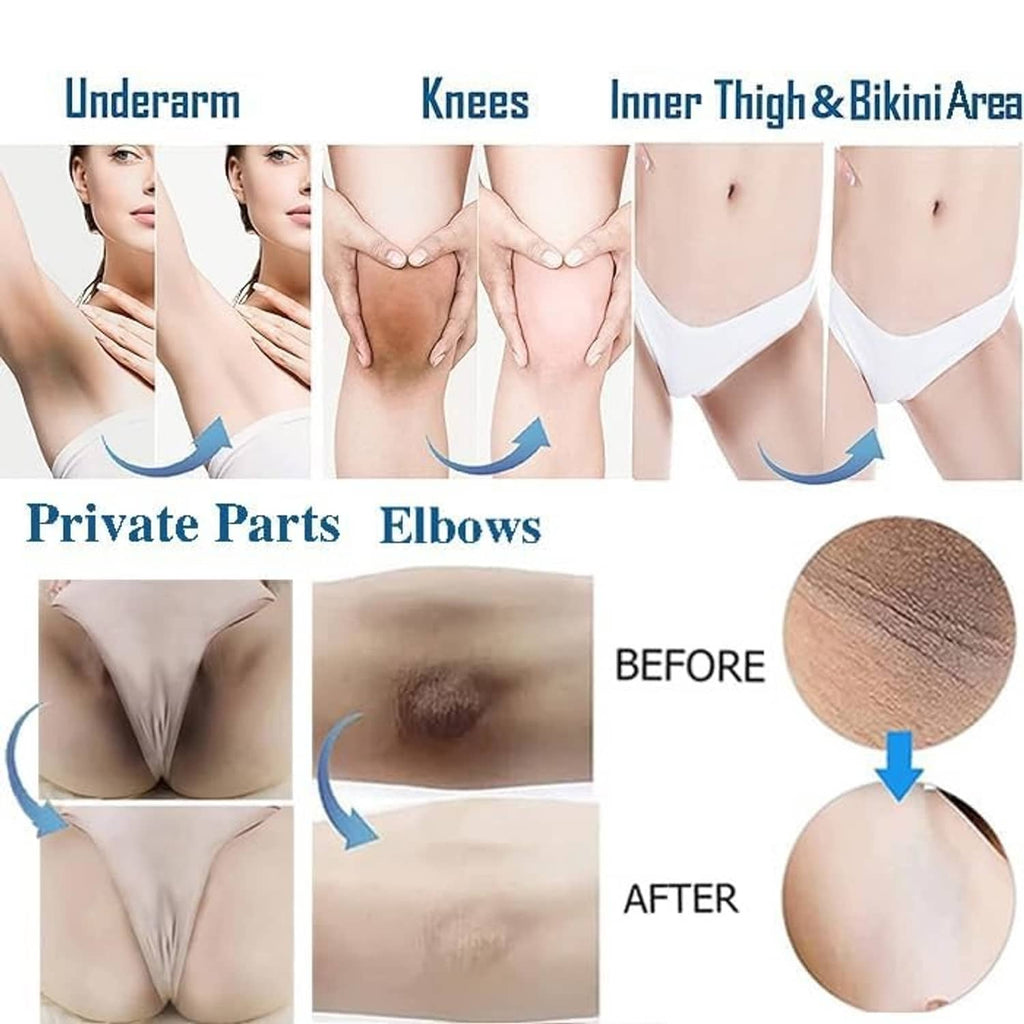 Skin lightening cream shown on private areas with before-and-after panels