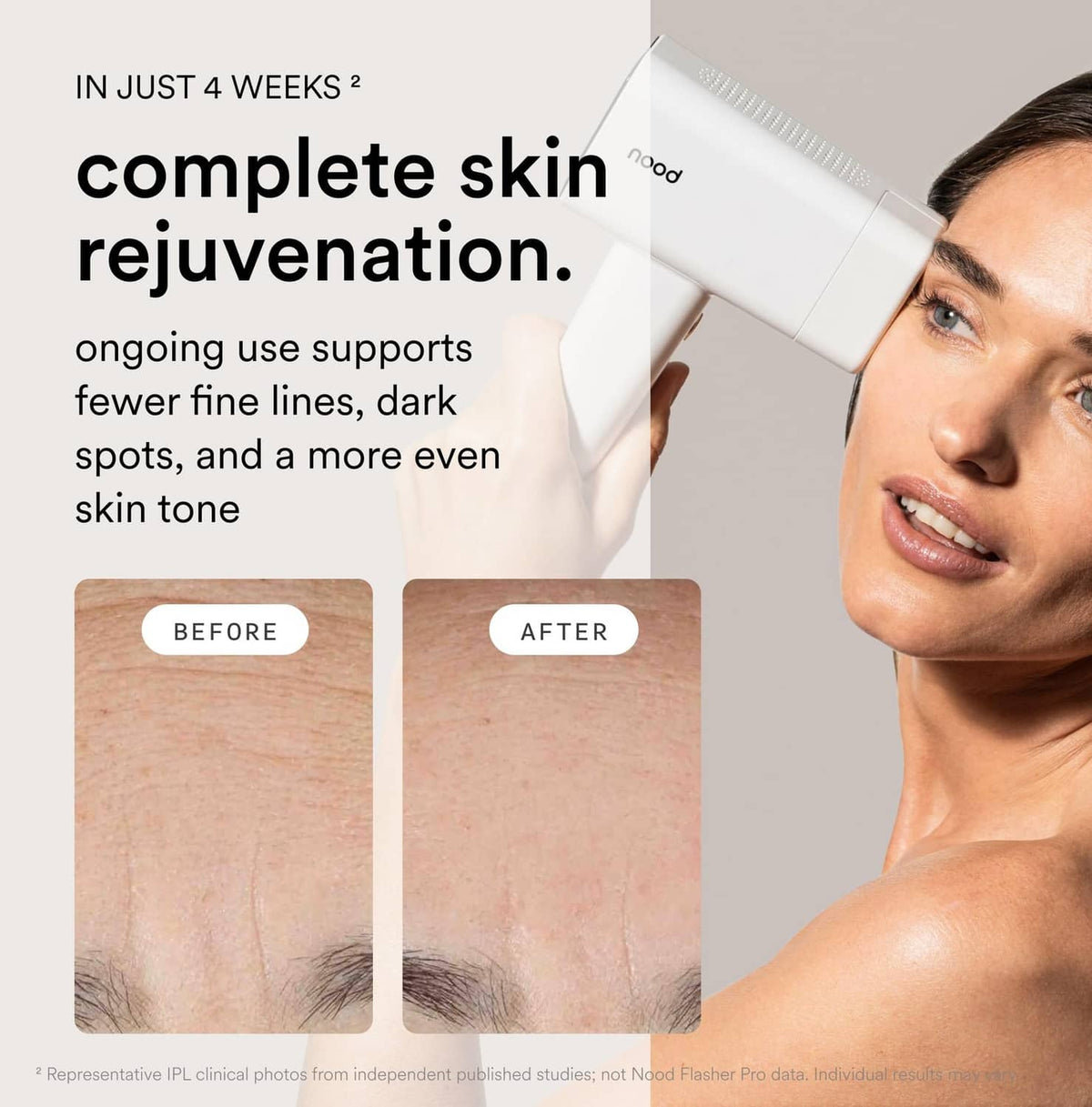 Matte white and black IPL device placed on the cheek area for skin treatment