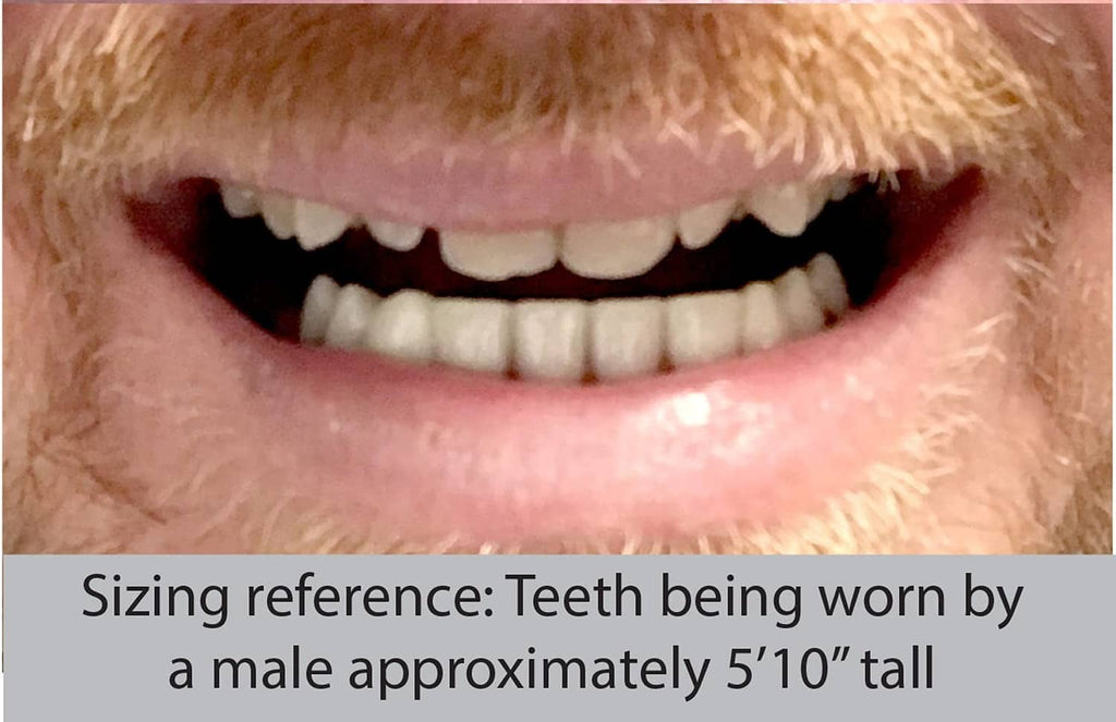 Close-up of cosmetic lower teeth in mouth for sizing reference, white teeth on pink base.