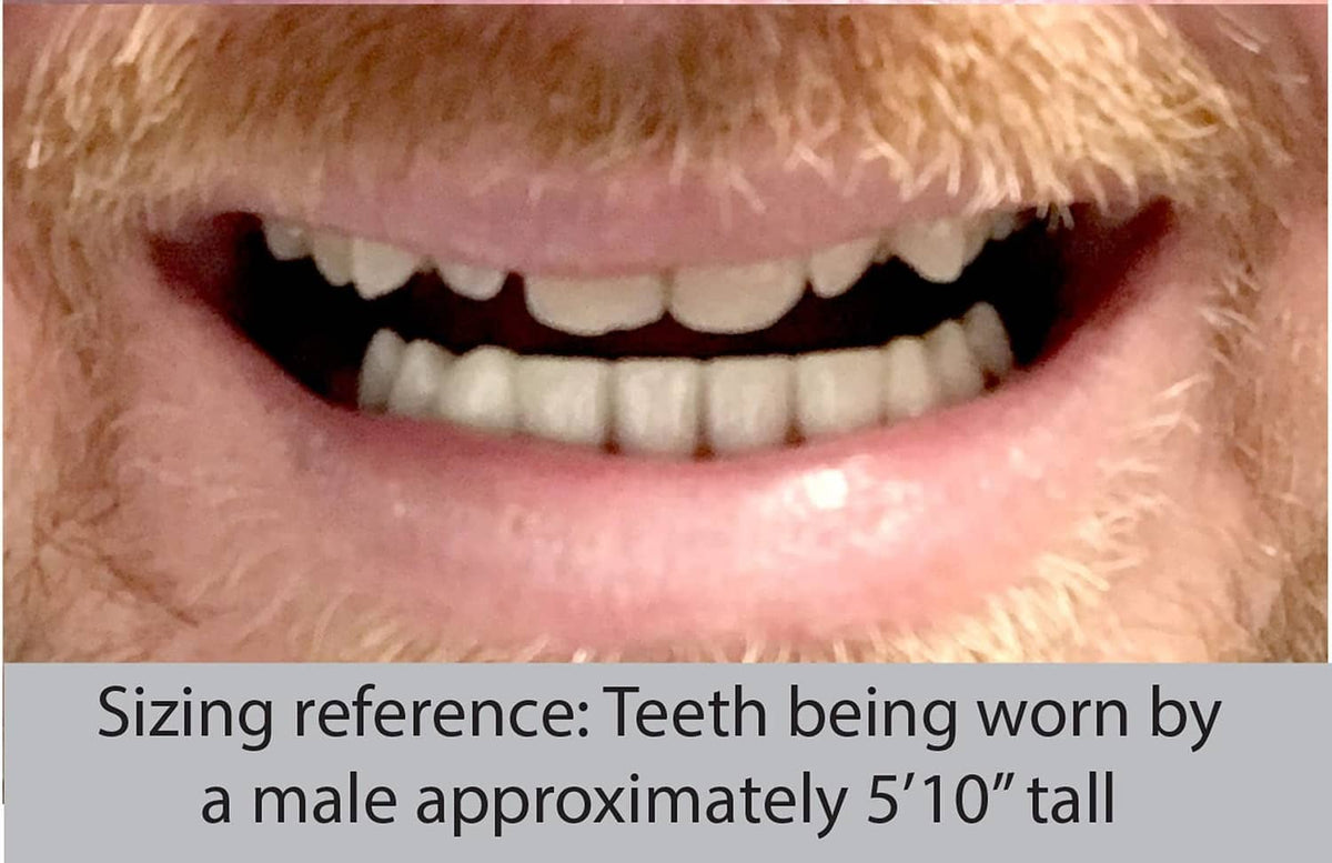 Close-up of cosmetic lower teeth in mouth for sizing reference, white teeth on pink base.