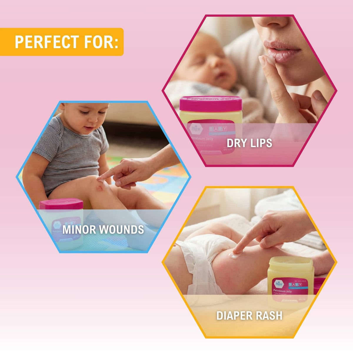 Petroleum jelly jar with pink lid, shown for diaper rash and minor skin protection