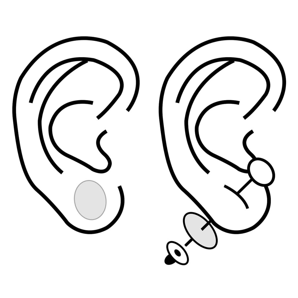 Ear adhesive dot stickers shown on ear outlines