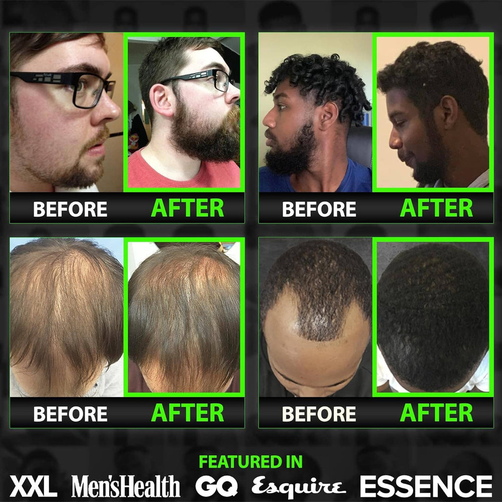 Hair growth results collage with before and after scalp photos