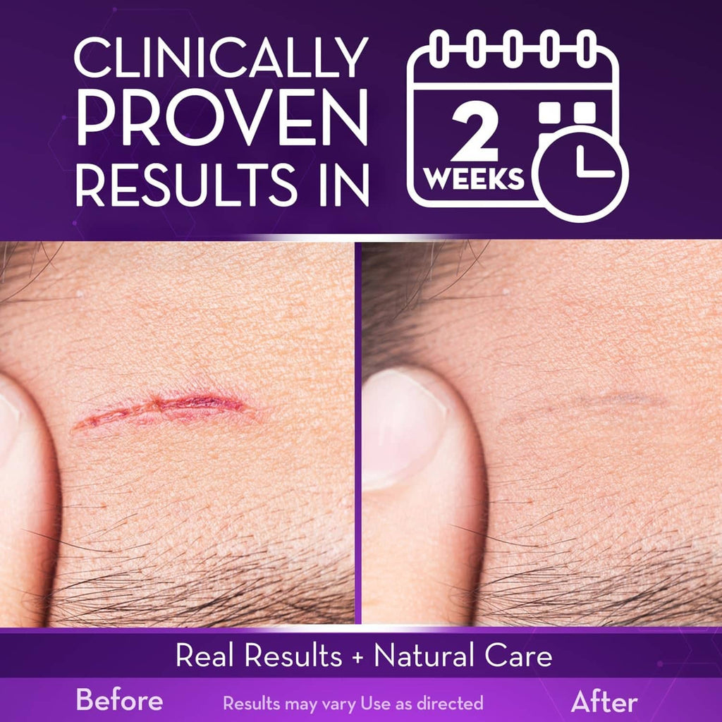 Scar gel results on skin: close-up before and after on a small scar