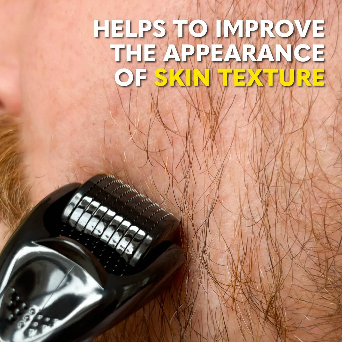 Derma roller with micro needles on skin for improved skin texture appearance