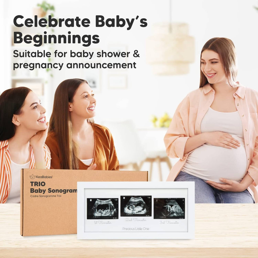 Ultrasound trio keepsake frame displaying three sonogram images with gift packaging