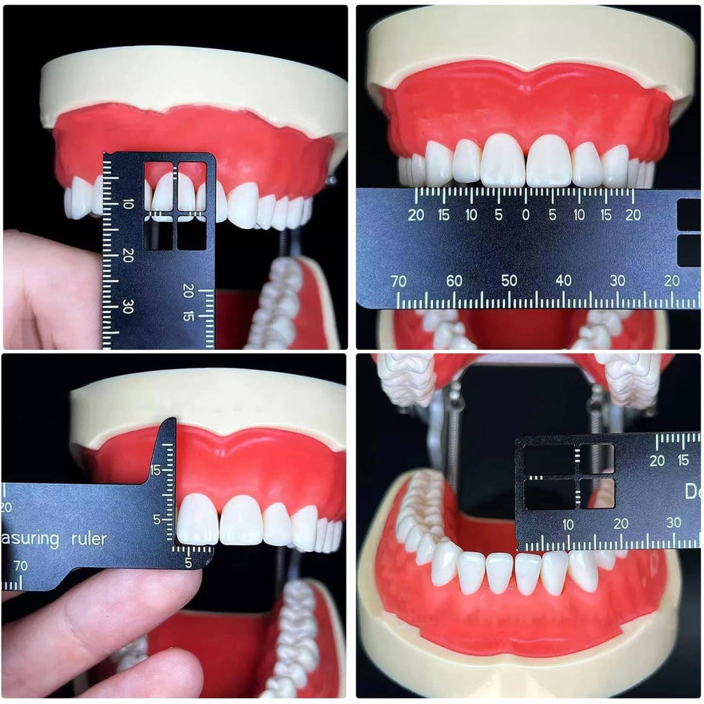 Black dental measuring ruler placed across a model, showing etched measurement scale