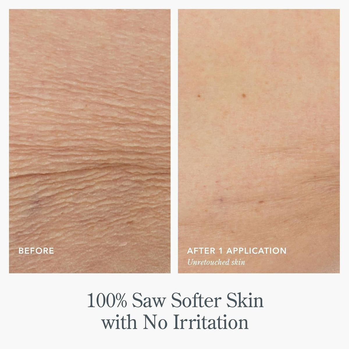 Before and after skin texture panels showing smoother look after body cream use