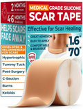 Beige medical-grade silicone scar tape roll and strip, 1.6 in by 70 in