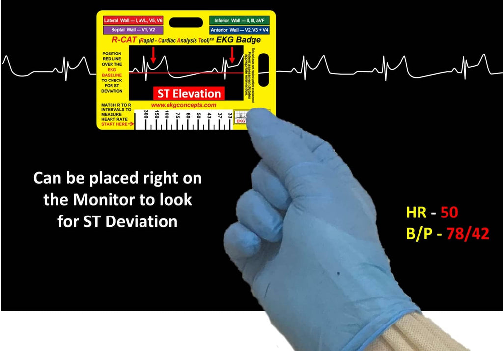 EKG analysis badge on screen with gloved hand, yellow card marked for ST deviation