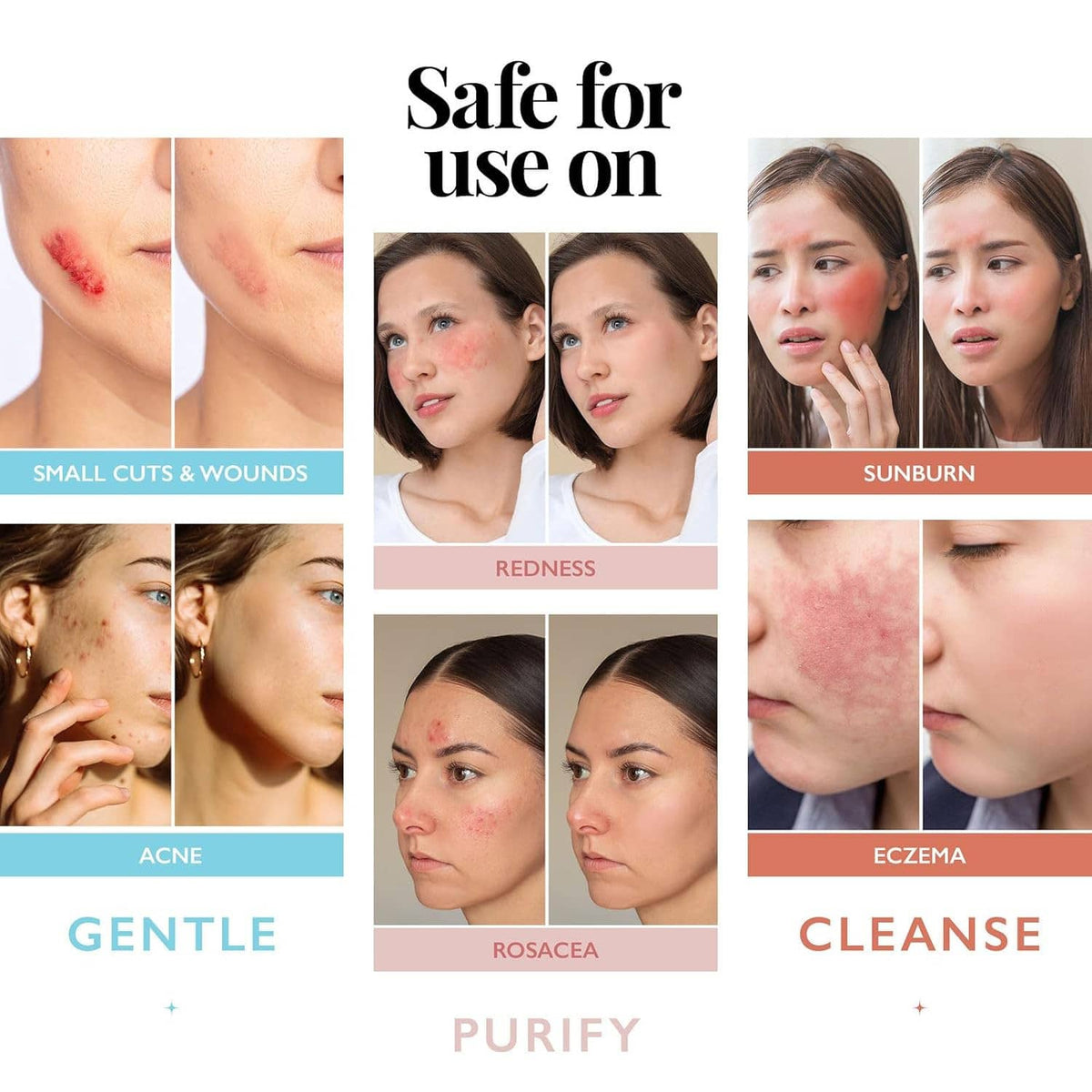 Facial skin care icons collage for cleansing, purifying, and soothing redness