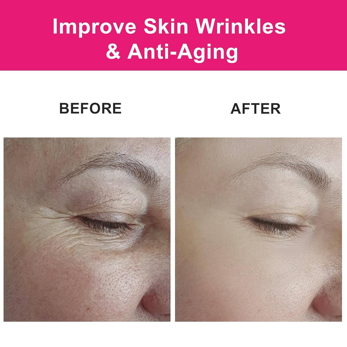 Rosehip seed oil skincare results shown in wrinkle before-and-after halves