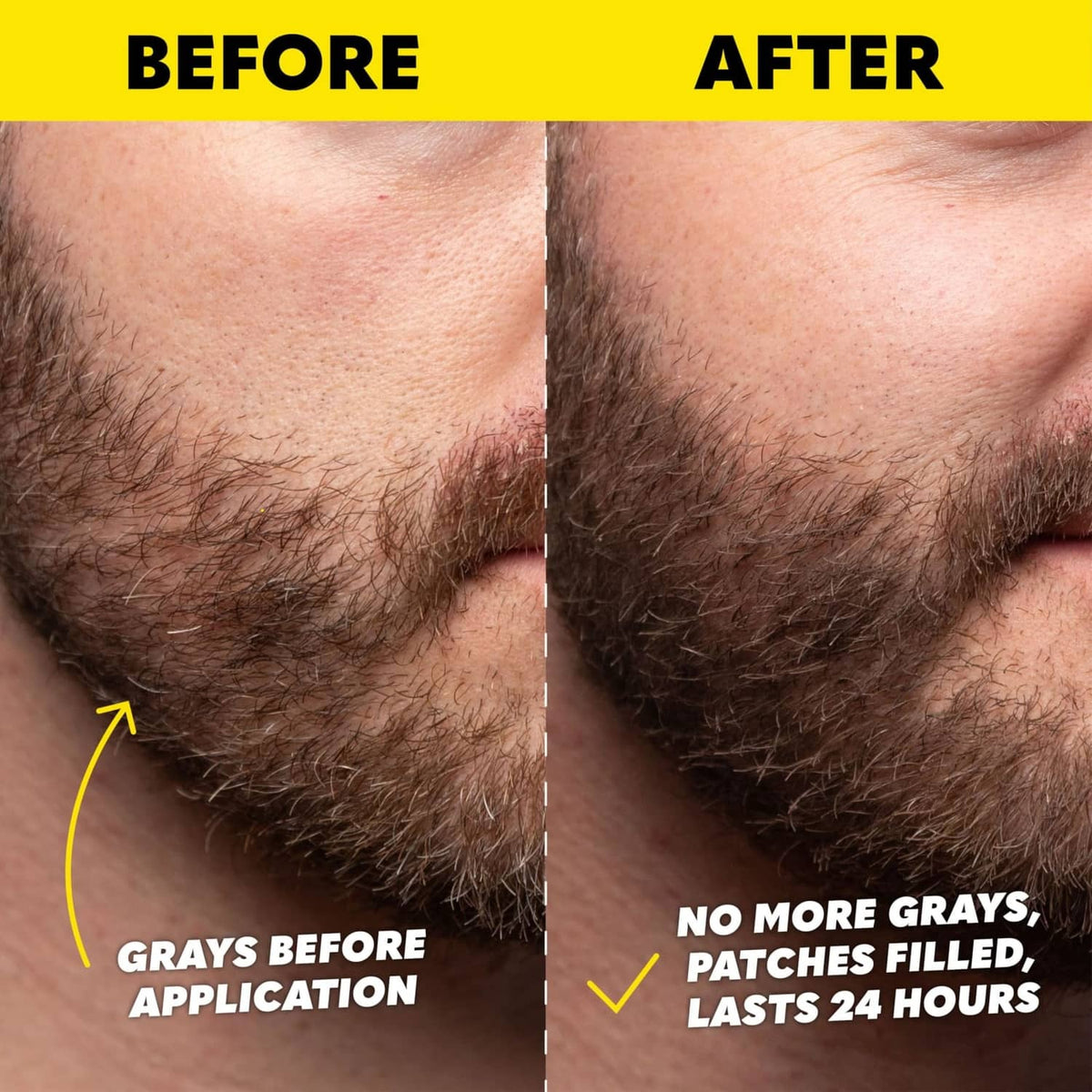 Temporary beard dye before-and-after view showing reduced gray patches