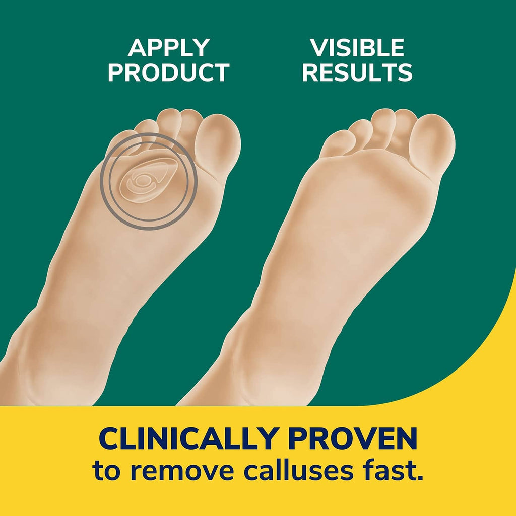 Callus remover seal & heal bandage application on bare foot
