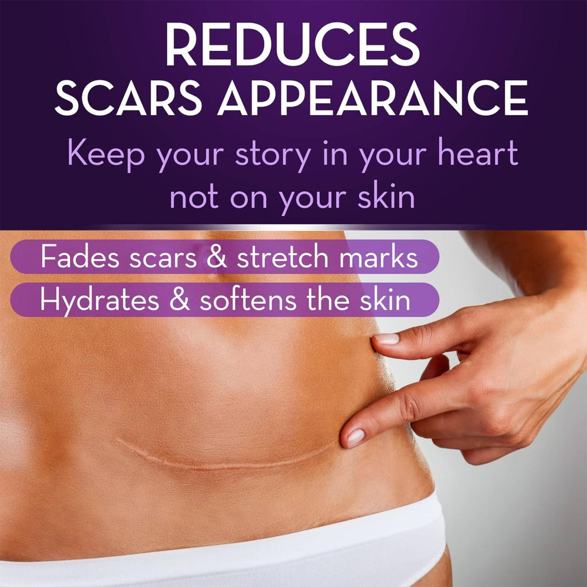 Scar gel application on abdomen skin with hand massaging the area