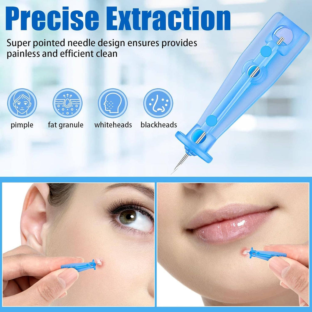 Blue disposable acne lancet with fine pointed needle for precise skin extraction
