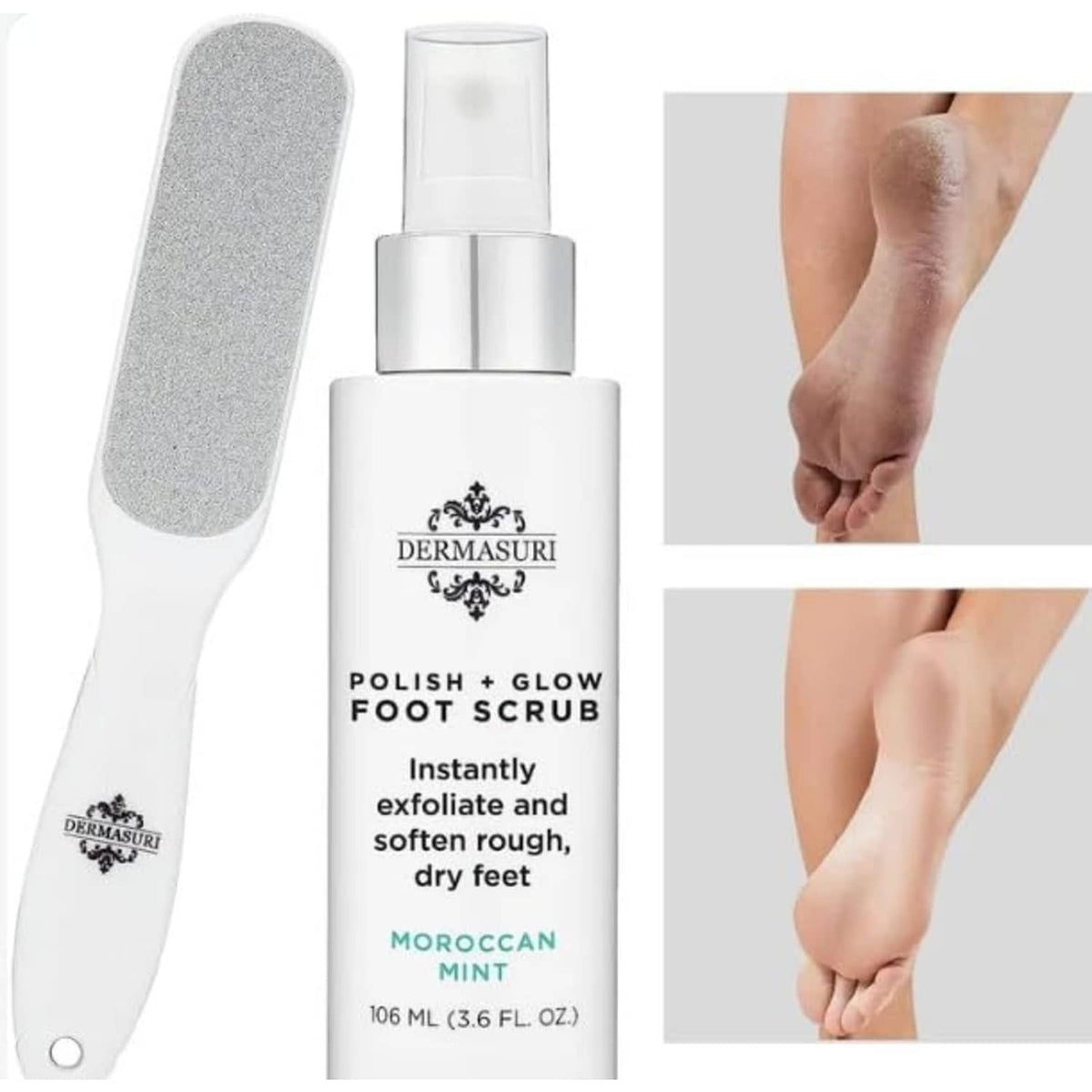 Foot scrub bottle and dual-sided foot file kit with gray filing pads and white spray top