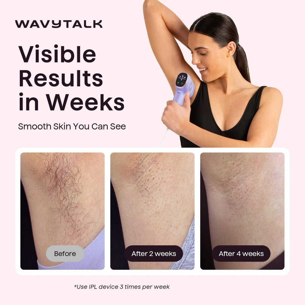 Wavytalk purple IPL hair removal device held against forearm